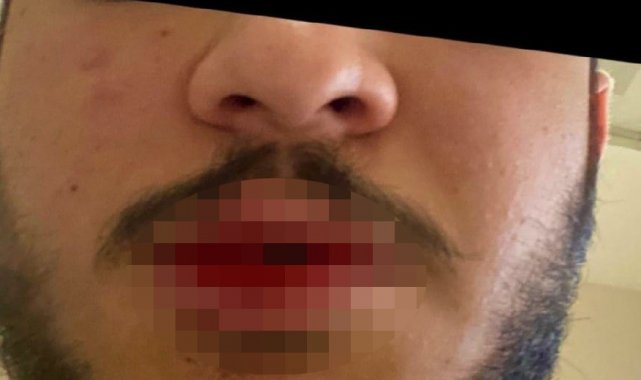 Kars'ta sağlık çalışanı darp edildi