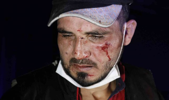 Köpek havlayınca vatandaşlar hırsızı yakaladı, ardından öldüresiye darp etti