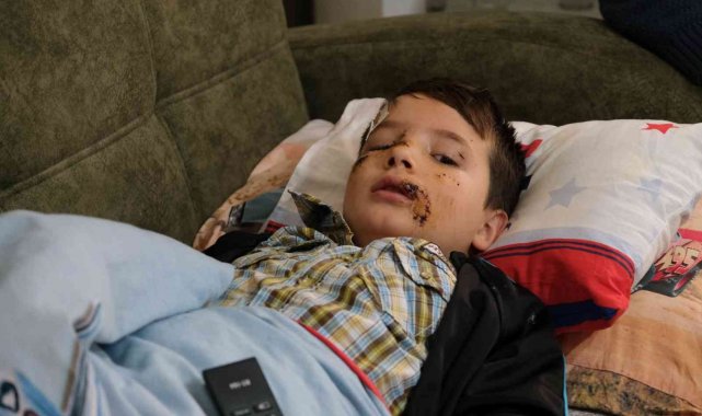 Sokak köpeğinin saldırısına uğrayan çocuk ölümden döndü