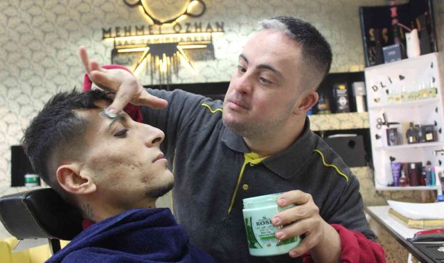 +1 kromozomu hayata atılmasına engel olmadı