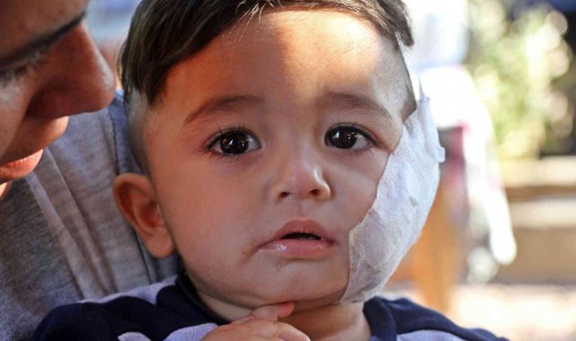 11 aylıkken pitbull saldırısına uğrayan minik Sadrettin, anne kelimesinden önce 'acıyor'u öğrendi