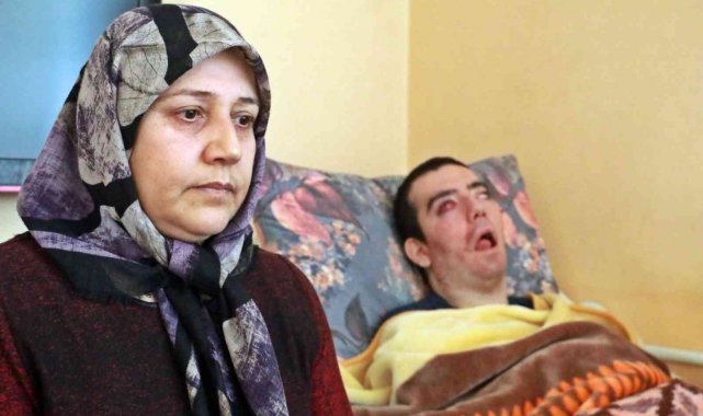 8 yıldır gözlerini kırpamıyor, adeta kan ağlıyor