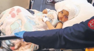 Anne yüzüm iyileşecek mi?