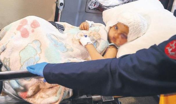 Anne yüzüm iyileşecek mi?