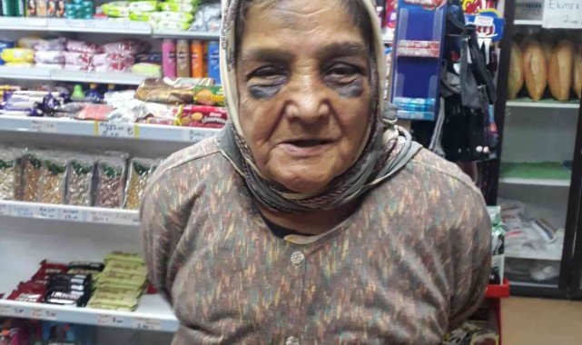 Demir çubukla 73 yaşındaki eşini döven adam hakkında yasal işlem başlatıldı