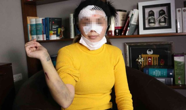 Eşinin yüzünü bıçakladığı kadın, dehşet anlarını anlattı