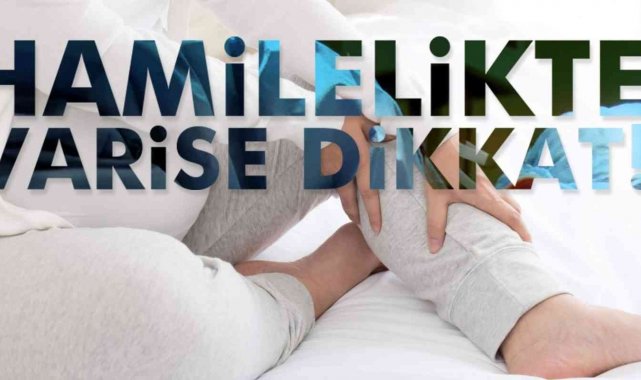 Hamilelikte varis gelişimine dikkat