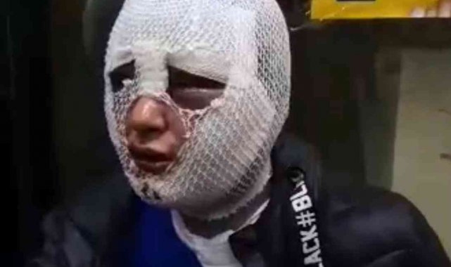 İskenderun'da eski sözlü dehşeti