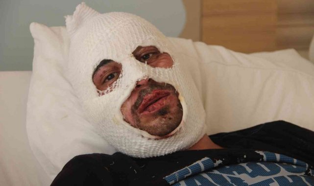 Kafe yangınında canını zor kurtardı