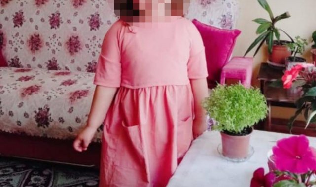 Küçük kızın vücudundaki morluklar iğrenç bir olayı ortaya çıkardı