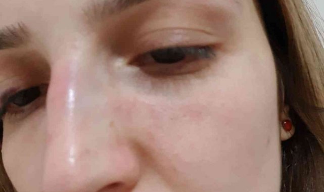 Mahalle muhtarı eski sevgilisine dehşeti yaşattı