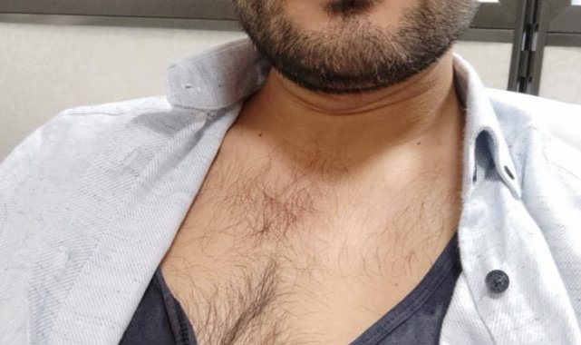 Nevşehir'de doktora çirkin saldırı