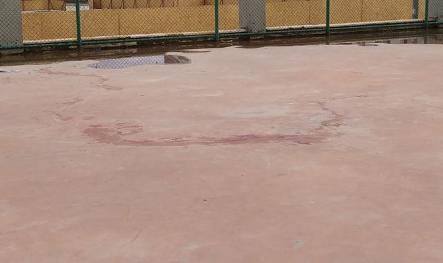 Pitbull cinsi iki köpeğin saldırdığı 4 yaşındaki çocuk ağır yaralandı