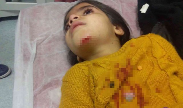 Rögar kapağı açık bırakıldı, 7 yaşındaki çocuk belediyenin çukuruna düştü