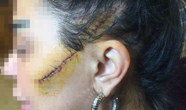 Saplantılı aşık dehşeti