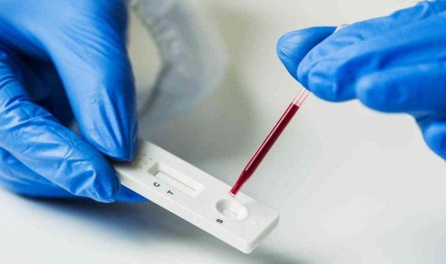 Türk bilim insanları 48 farklı antikor test kitini değerlendirdi
