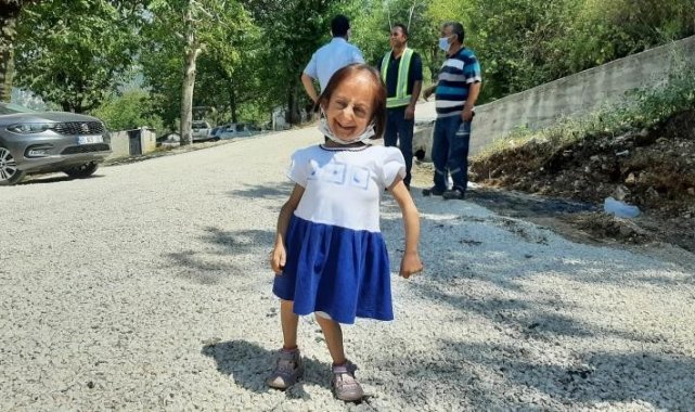 Türkiye&#039;nin en kısa boylu kadını hayatını kaybetti