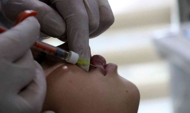 Yanlış uygulanan dudak dolguları körlüğe yol açabiliyor