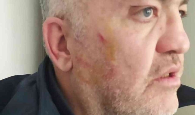 Ambulans şoförü darp edildi