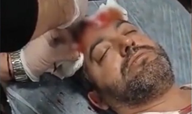 Avukata beyzbol sopalı saldırıda bulunan sanık için istenen ceza belli oldu