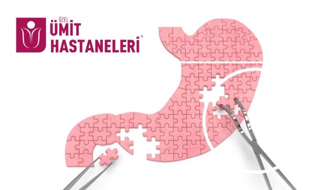 Bu ameliyat ile aç hissetmeden kilo vermek mümkün