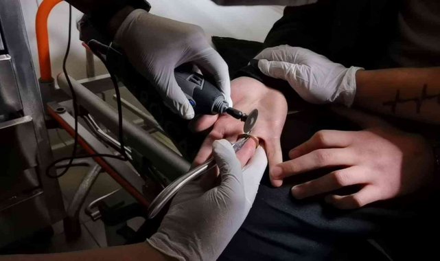 Bursa'da ilginç olay: Parmağına 1 TL sıkıştı