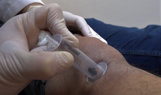 Doktor sülükler şifa kaynağı