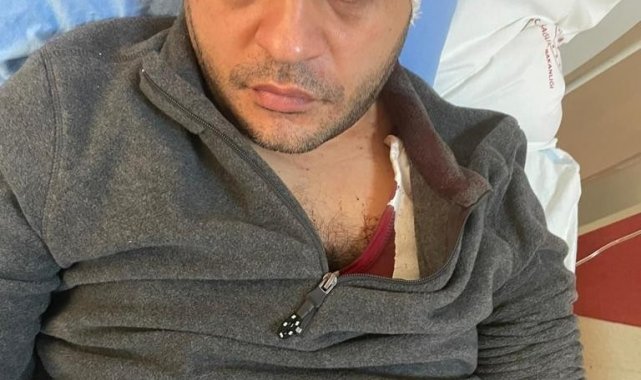 Gaziantep'te hasta yakınından doktora mermerli saldırı