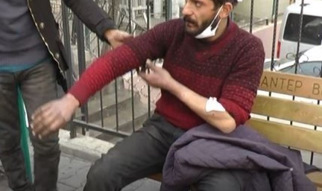 Gaziantep&#039;teki ikinci pitbull saldırısında 2 şahıs gözaltına alındı