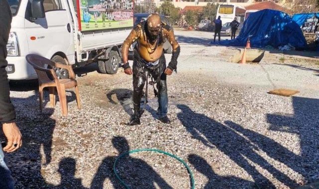 Her yeri yandı, hiçbir şey olmamış gibi derdini anlatmaya çalıştı