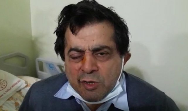 Kafasına çatıdan buz kütlesi düştü, ölümden döndü