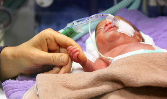 Parmak bebeğe kalp ameliyatı