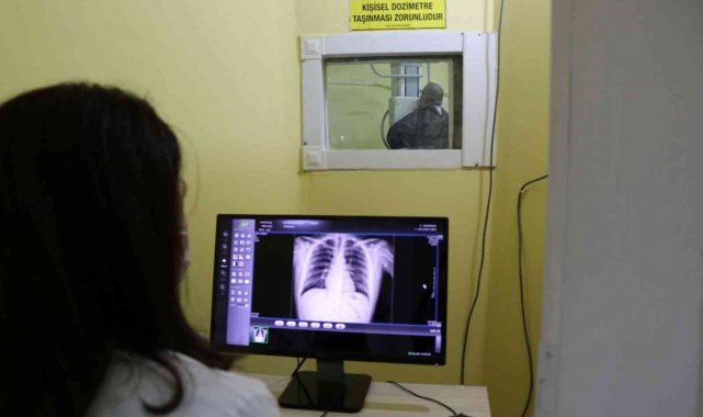 "Tüberküloz tedavi edilebilir bir hastalıktır"