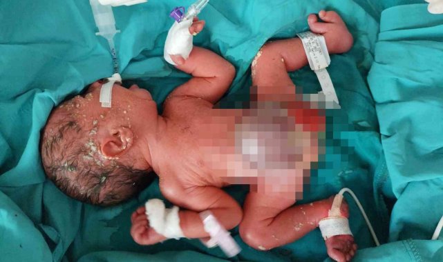 Siirt'te ambulans uçak 2 günlük bebek için havalandı