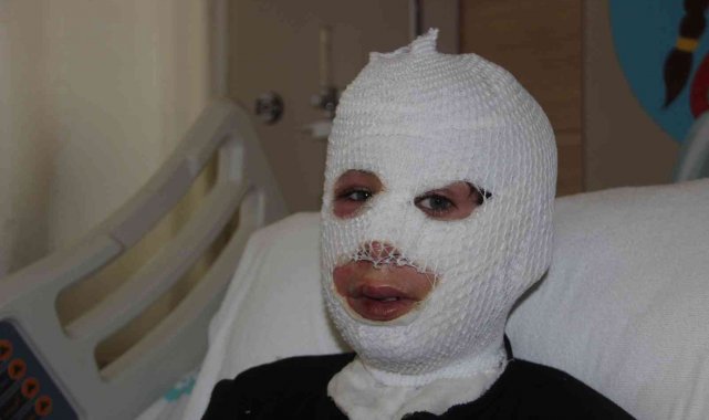 Sobada ayaklarını ısıtırken kendini yaktı