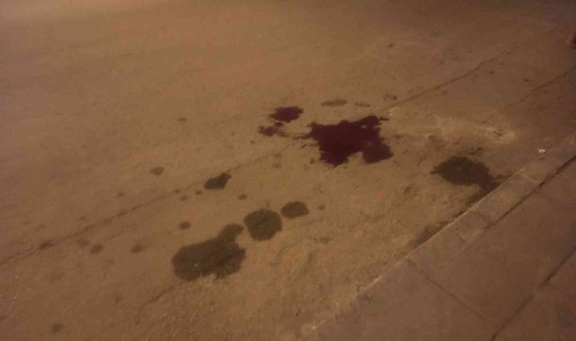 Ankara'da silahlı saldırı sonucu bir vatandaş iki bacağından birden vuruldu