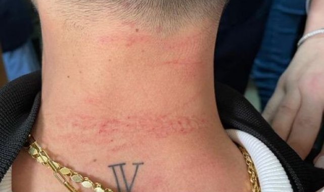 Cerrahpaşa Tıp Fakültesi'nde doktora saldıran şüpheli gözaltına alındı