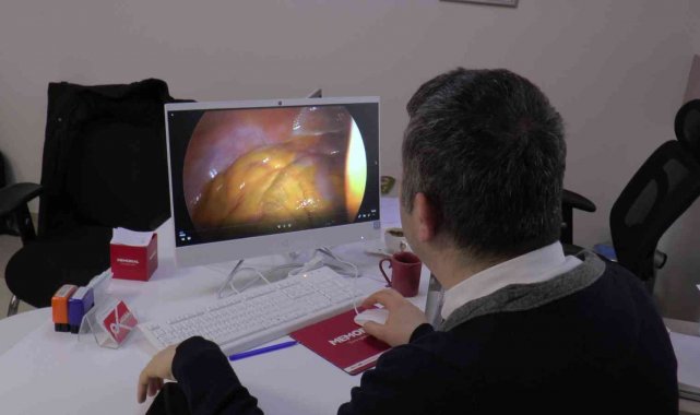 Hastalar için kolay tedavi: &quot;Laparoskopik Cerrahi&quot;