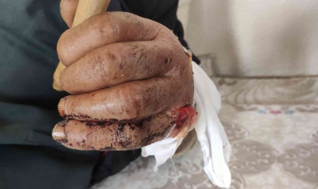 Mardin'de kimliksiz, yaşlı, kimsesiz adam 'sokak köpeği' saldırısına uğradı