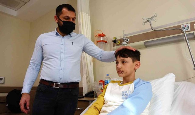 Minik Asiye gibi yüzünden yaralanan Berat&#039;tan sevindiren haber