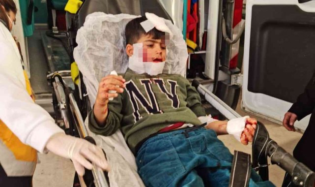 Nusaybin'de köpeklerin saldırısına uğrayan çocuk ağır yaralandı