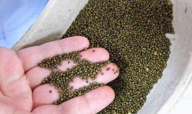 Safra kesesinden çıkanlar şaşırttı, Guinness'e başvuru yapacaklar