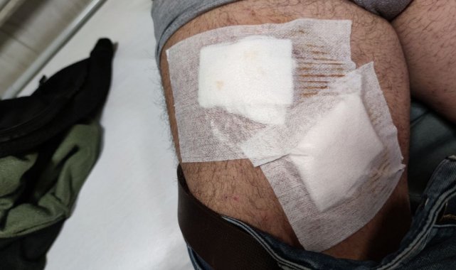 Tarladaki çiftçi köpeklerin saldırısına uğradı