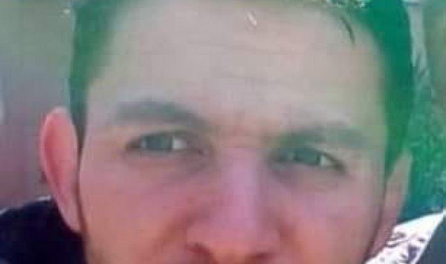 Araştırma görevlisi kanserden hayatını kaybetti