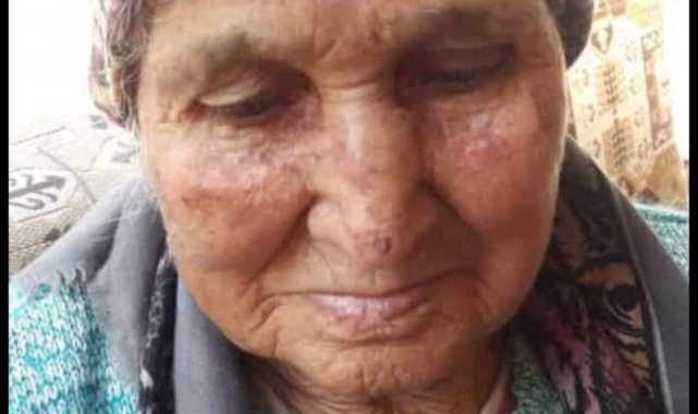 Bir gün içinde hem annesini hem de kayınvalidesini kaybetti