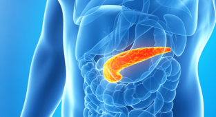 Dışkı testi ile pankreas kanserinin erken teşhisi mümkün olacak mı?