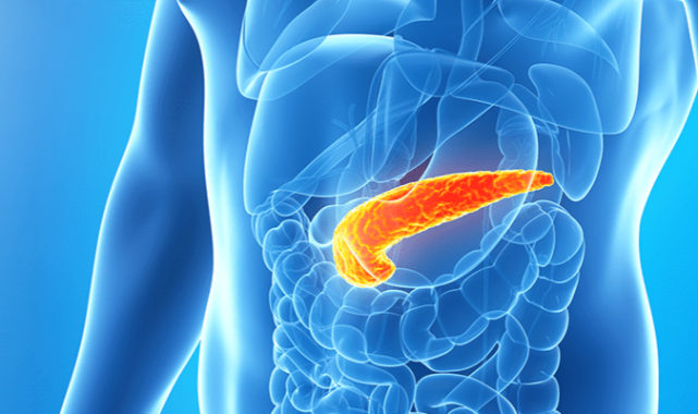 Dışkı testi ile pankreas kanserinin erken teşhisi mümkün olacak mı?