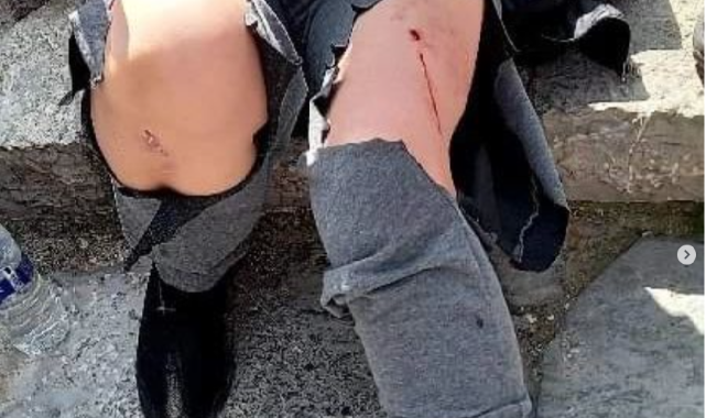 Köpeklerin Saldırısına Uğradı..