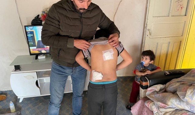 Okula giderken iki köpeğin saldırısına uğradı