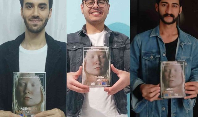 ADÜ öğrenciler albinizmli bireyler üzerine proje gerçekleştirdi
